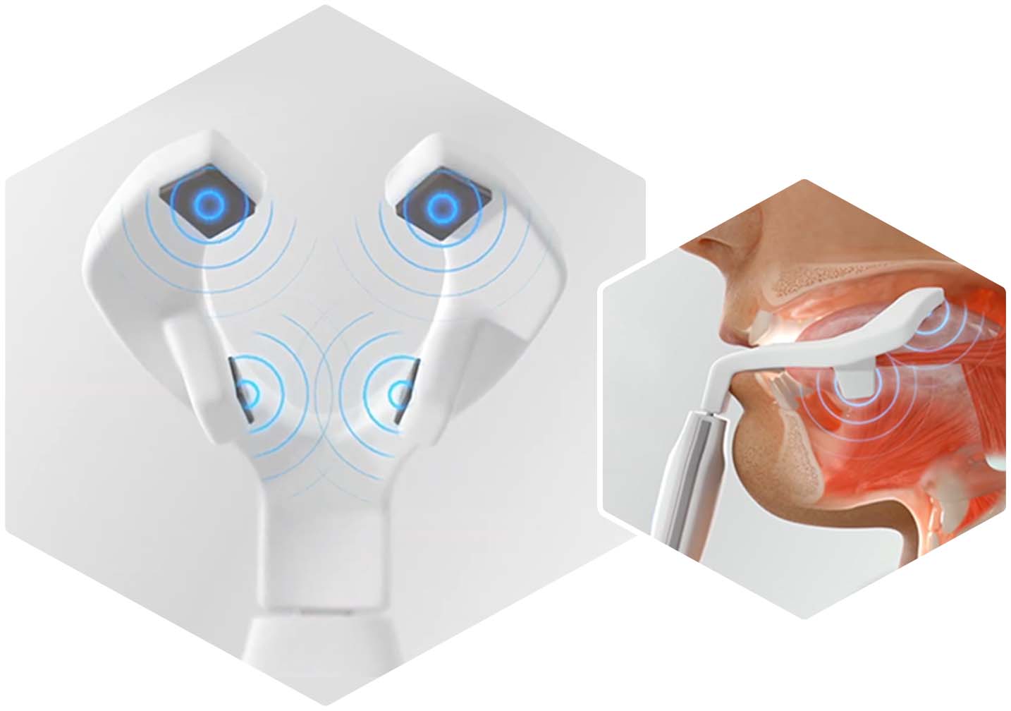 SnoreLess Sleep Device (powered by eXciteOSA) - SnoreLessSleep